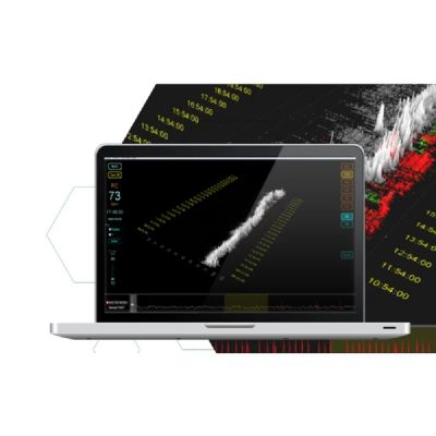 Nomad Analisador Holter Digital 