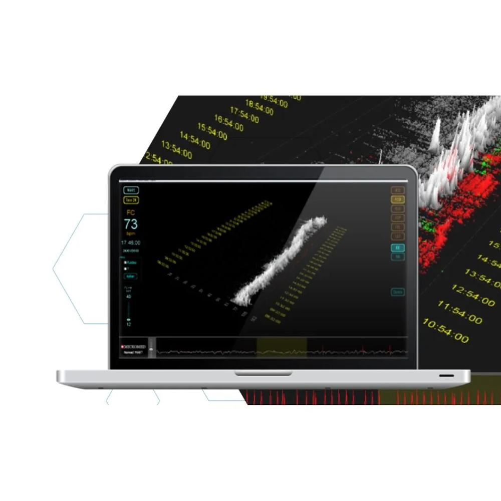 Nomad Analisador Holter Digital 